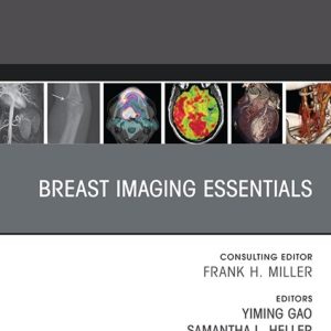 Breast Imaging Essentials, An Issue of Radiologic Clinics of North America (True PDF from Publisher)