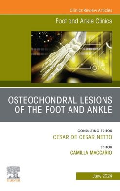 Osteochondral Lesions of the Foot and Ankle, An issue of Foot and Ankle Clinics of North America (True PDF from Publisher)