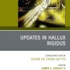 Updates in Hallux Rigidus, An issue of Foot and Ankle Clinics of North America (True PDF from Publisher)