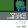 Advanced Imaging in Ischemic and Hemorrhagic Stroke, An Issue of Neuroimaging Clinics of North America (True PDF from Publisher)