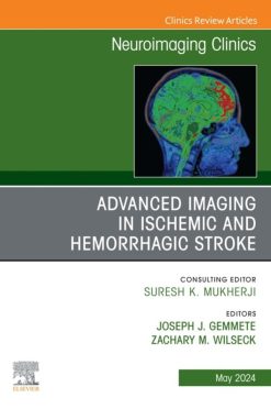 Advanced Imaging in Ischemic and Hemorrhagic Stroke, An Issue of Neuroimaging Clinics of North America (True PDF from Publisher)