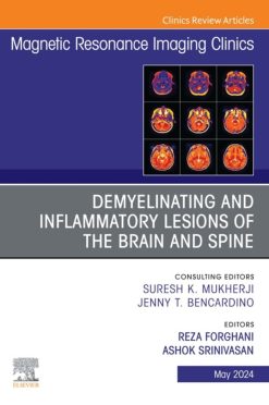 Demyelinating and Inflammatory Lesions of the Brain and Spine, An Issue of Magnetic Resonance Imaging Clinics of North America (True PDF from Publisher)