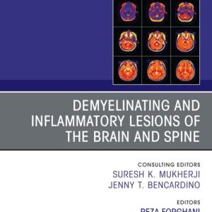 Demyelinating and Inflammatory Lesions of the Brain and Spine, An Issue of Magnetic Resonance Imaging Clinics of North America (True PDF from Publisher)