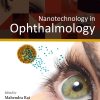 Nanotechnology in Ophthalmology (EPUB)