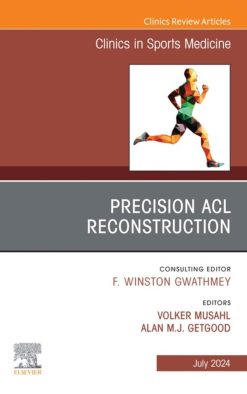 Precision ACL Reconstruction, An Issue of Clinics in Sports Medicine (True PDF from Publisher)