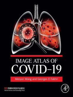Image Atlas of COVID-19 (Original PDF from Publisher)
