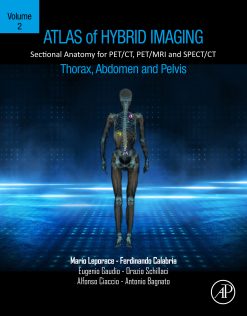 Atlas of Hybrid Imaging Sectional Anatomy for PET/CT, PET/MRI and SPECT/CT Vol. 2: Thorax Abdomen and Pelvis: Sectional Anatomy for PET/CT, PET/MRI and SPECT/CT (EPUB)