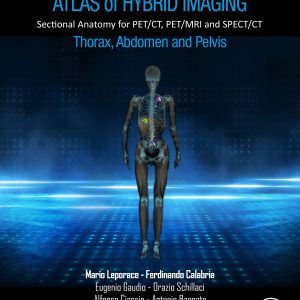 Atlas of Hybrid Imaging Sectional Anatomy for PET/CT, PET/MRI and SPECT/CT Vol. 2: Thorax Abdomen and Pelvis: Sectional Anatomy for PET/CT, PET/MRI and SPECT/CT (EPUB)