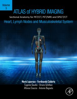 Atlas of Hybrid Imaging Sectional Anatomy for PET/CT, PET/MRI and SPECT/CT Vol. 3: Heart, Lymph Node and Musculoskeletal System: Sectional Anatomy for PET/CT, PET/MRI and SPECT/CT (EPUB)
