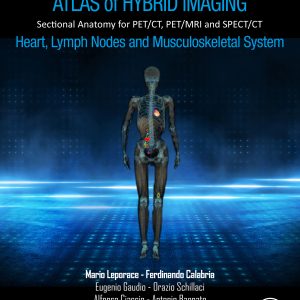 Atlas of Hybrid Imaging Sectional Anatomy for PET/CT, PET/MRI and SPECT/CT Vol. 3: Heart, Lymph Node and Musculoskeletal System: Sectional Anatomy for PET/CT, PET/MRI and SPECT/CT (EPUB)