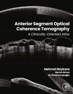 Anterior Segment Optical Coherence Tomography: A Clinically-Oriented Atlas (True PDF from Publisher)