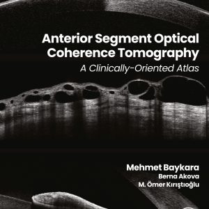 Anterior Segment Optical Coherence Tomography: A Clinically-Oriented Atlas (True PDF from Publisher)