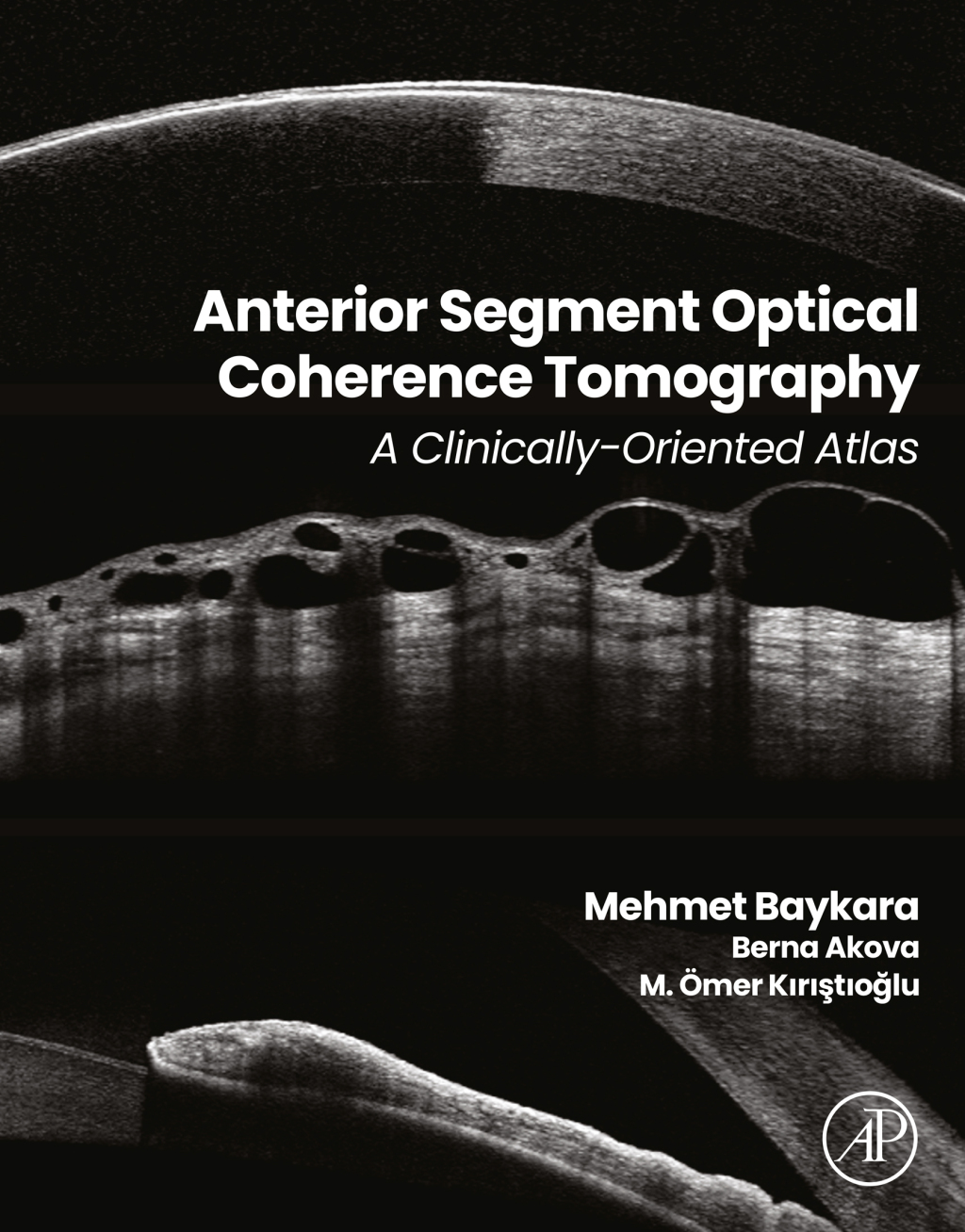 Anterior Segment Optical Coherence Tomography: A Clinically-Oriented Atlas (True PDF from Publisher)