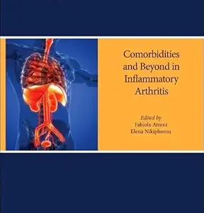 Inflammatory Arthritis Beyond the Joints: Comorbidities and other Manifestations (Volume 18) (Handbook of Systemic Autoimmune Diseases, Volume 18) (EPUB)