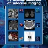 A Practical Handbook of Endocrine Imaging (EPUB)