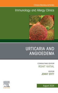 Urticaria and Angioedema, An Issue of Immunology and Allergy Clinics of North America (True PDF from Publisher)