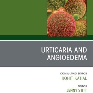 Urticaria and Angioedema, An Issue of Immunology and Allergy Clinics of North America (True PDF from Publisher)