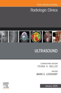 Ultrasound, An Issue of Radiologic Clinics of North America (True PDF from Publisher)