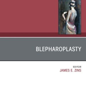 Blepharoplasty, An Issue of Clinics in Plastic Surgery (True PDF from Publisher)
