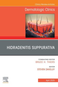 Hidradenitis Suppurativa, An Issue of Dermatologic Clinics (Original PDF from Publisher)