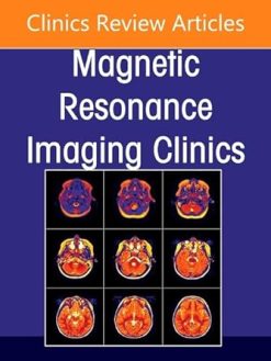 Plexus and Peripheral Nerve MR Imaging: Advances and Applications, An Issue of Magnetic Resonance Imaging Clinics of North America (Volume 33-3) (The Clinics: Radiology, Volume 33-3) (EPUB)