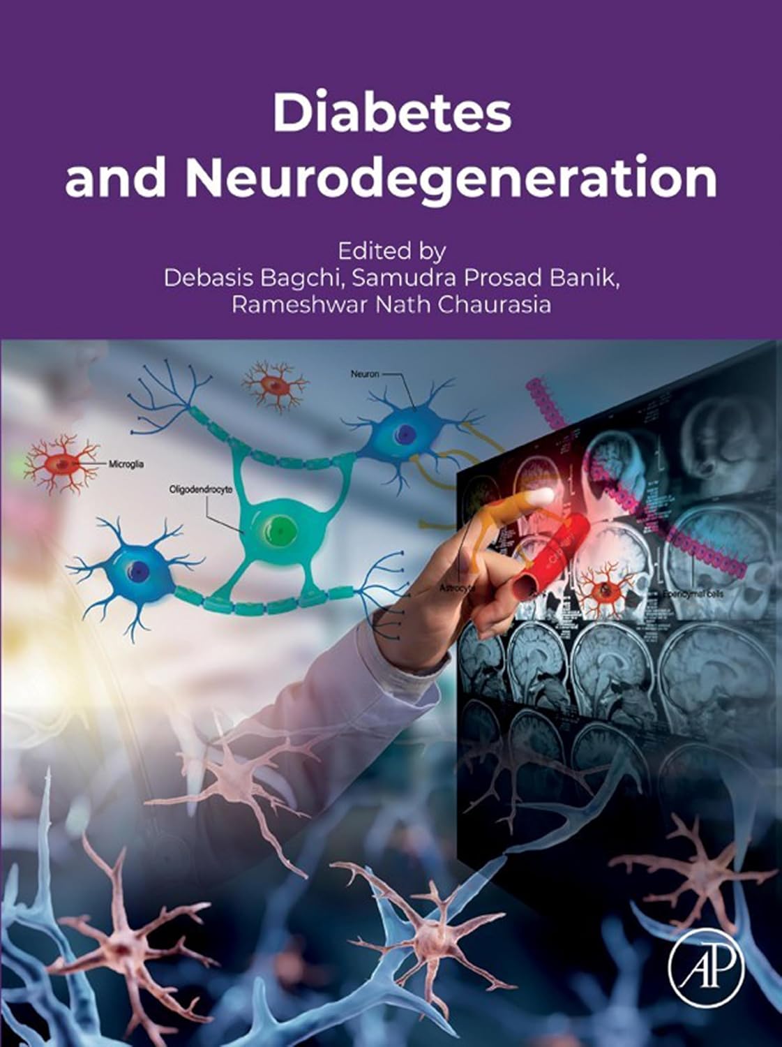 Diabetes and Neurodegeneration (Original PDF from Publisher)