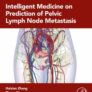 Intelligent Medicine on Prediction of Pelvic Lymph Node Metastasis (True PDF from Publisher)