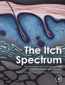 The Itch Spectrum (Original PDF from Publisher)