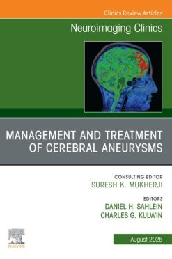Management and Treatment of Cerebral Aneurysms, An Issue of Neuroimaging Clinics of North America (EPUB)
