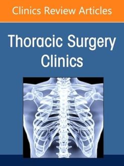 Management of Intraoperative Disasters, An Issue of Thoracic Surgery Clinics (Volume 35-3) (The Clinics: Internal Medicine, Volume 35-3) (EPUB)