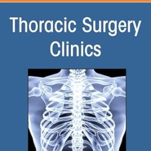 Management of Intraoperative Disasters, An Issue of Thoracic Surgery Clinics (Volume 35-3) (The Clinics: Internal Medicine, Volume 35-3) (EPUB)