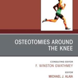 Osteotomies Around the Knee, An Issue of Clinics in Sports Medicine (Original PDF from Publisher)
