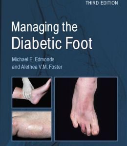 Managing the Diabetic Foot