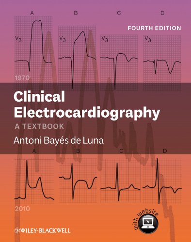 Clinical Electrocardiography: A Textbook, 4th Edition (Original PDF from Publisher)