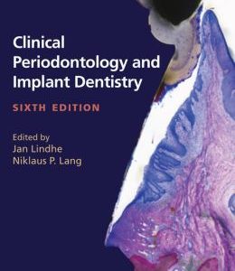 Clinical Periodontology and Implant Dentistry, 6th Edition