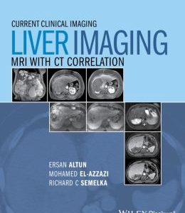 Liver Imaging: MRI with CT Correlation