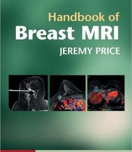 Handbook of Breast MRI