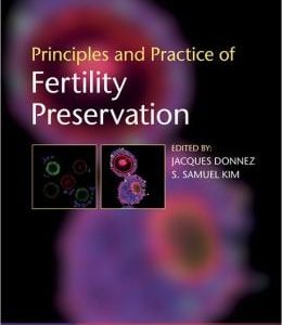 Principles and Practice of Fertility Preservation