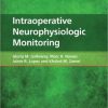 Intraoperative Neurophysiologic Monitoring