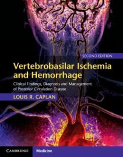 Vertebrobasilar Ischemia and Hemorrhage, 2nd Edition (ORIGINAL PDF from Publisher)