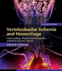 Vertebrobasilar Ischemia and Hemorrhage, 2nd Edition (ORIGINAL PDF from Publisher)