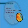 Toole’s Cerebrovascular Disorders, 6th Edition (Original PDF from Publisher)