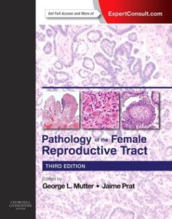Pathology of the Female Reproductive Tract, 3rd Edition