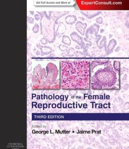 Pathology of the Female Reproductive Tract, 3rd Edition