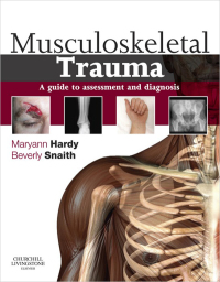 Musculoskeletal Trauma: A guide to assessment and diagnosis (Original PDF from Publisher)