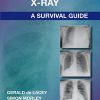The Chest X-Ray: A Survival Guide (Original PDF from Publisher)