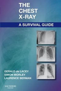 The Chest X-Ray: A Survival Guide (Original PDF from Publisher)