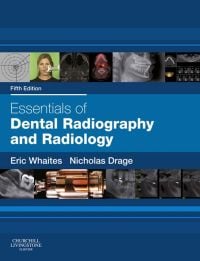 Essentials of Dental Radiography and Radiology, 5e (Original PDF from Publisher)