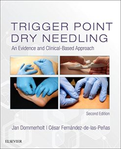 Trigger Point Dry Needling: An Evidence and Clinical-Based Approach, 2ed (PDF)