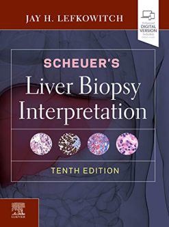 Scheuer’s Liver Biopsy Interpretation, 10th Edition (Original PDF from Publisher)